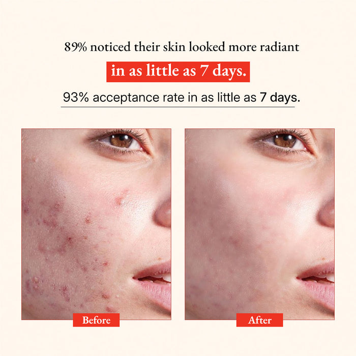 Glow Vitamin C Skin Brightening Serum