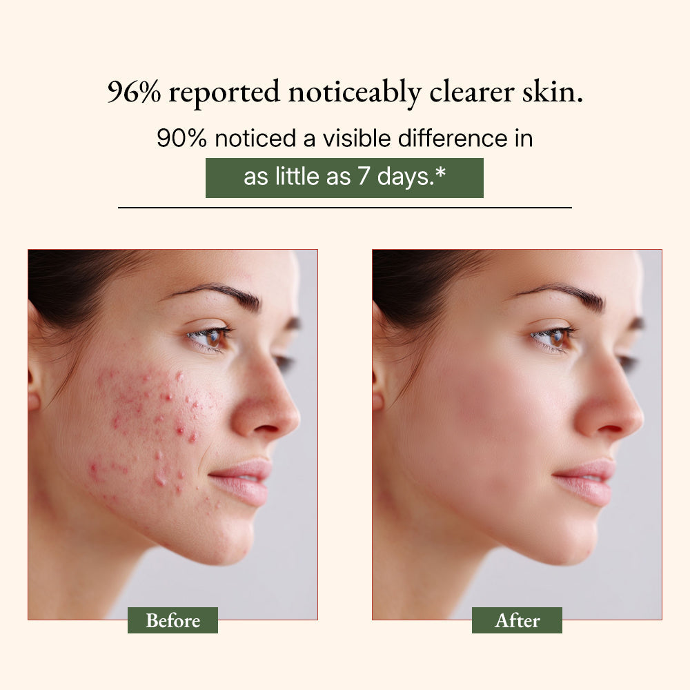 Ayurvedic Neem Cleansing Soap
