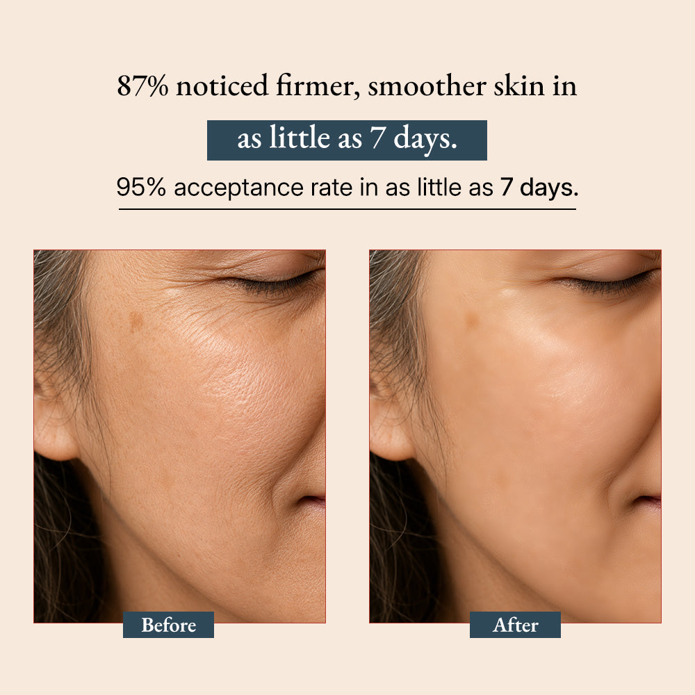 Supercharge Bakuchiol Retinol Serum